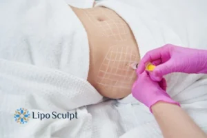 Are The Results From Aqualyx Permanent? 1 Do you want to know how long Aqualyx Horsham results last?
