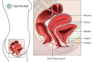 Treatment For A Leaky Bladder 2 How EM Chair treatment Horsham can help Leaky bladder issues. Read more now!