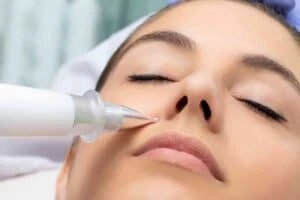 Best Actinic Keratoses Removal 3 Actinic keratoses Horsham solutions - book in today!