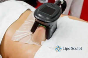 Does Fat Freezing At Home Work? 3 Fat freezing at home from Lipo Sculpt Horsham